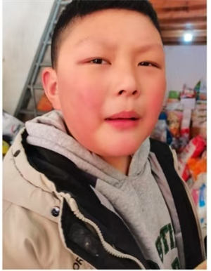史
