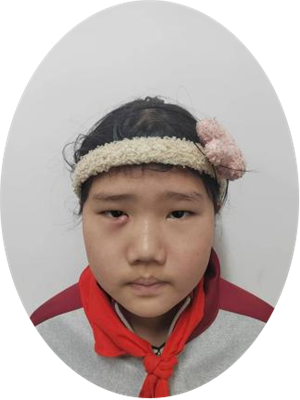 李